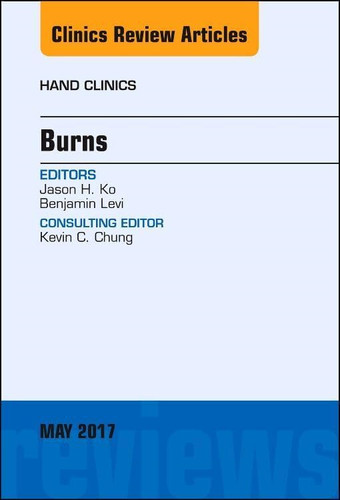 Burns issue of - an, hand