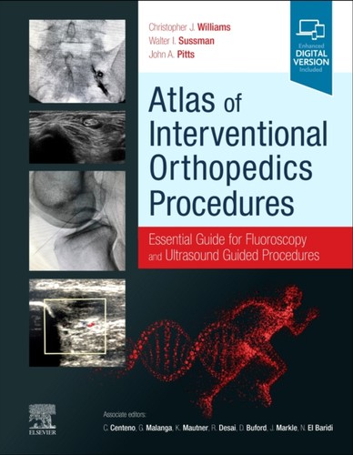 Atlas interventional - atlas,