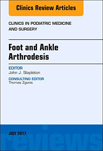 Foot and ankle - arthrodesis,, an