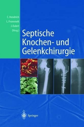 Septische knochen und - septische, knochen-und